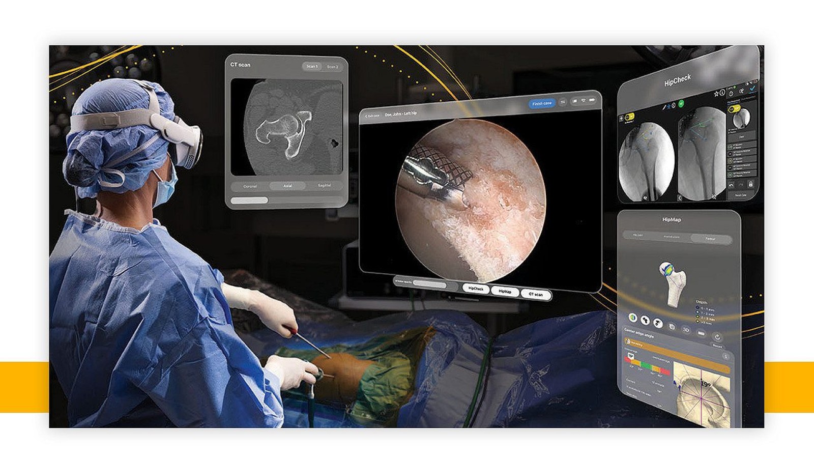 Apple Vision Pro Powers First-of-Its-Kind Surgery - Apple Vision Pro surgery